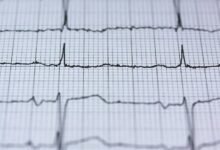 apex rise strategic pulse