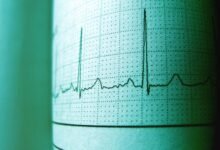 nova pulse 914842500 opportunity track