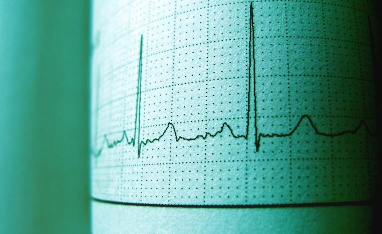 nova pulse 914842500 opportunity track